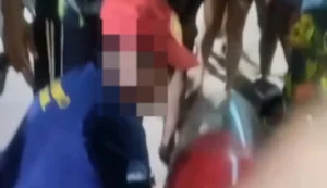 Motociclista fica ferido em colisão com carro de passeio em Japaratinga