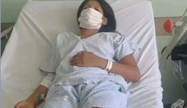 Criança sobe na cama, é picada por cobra e fica paralisada