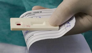 Alagoas registra 76 novos casos de Covid-19 e mais três mortes nesta quarta-feira (20)