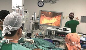 Santa Casa realiza primeira cirurgia por vídeo para retirada de tumor maligno
