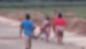 Homem é queimado por amigo durante discussão em Junqueiro