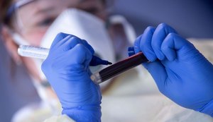 Alagoas registra 59 novos casos de Covid-19 e mais duas mortes nesta terça-feira (26)