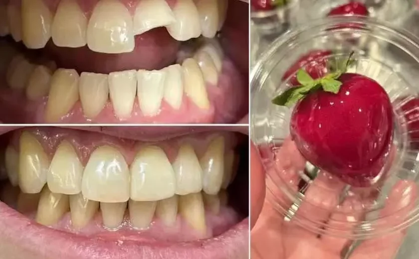 ‘Morango do Amor’ causa fraturas dentárias e dentistas alertam: ‘Bomba de açúcar’