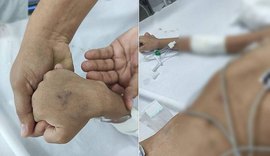 Menina de 5 anos agredida pelo pai e pela madrasta morre no HGE