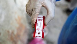 Alagoas registra 396 novos casos de Covid-19 e mais nove mortes neste sábado (16)