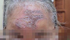 Vigilância Sanitária apreende produto que deixou fiéis com lesões na testa após missa no Trapiche