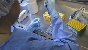 Brasil tem 17 casos confirmados de intoxicação por metanol