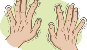 Pesquisadores transplantam células-tronco para cérebro para tratar mal de Parkinson