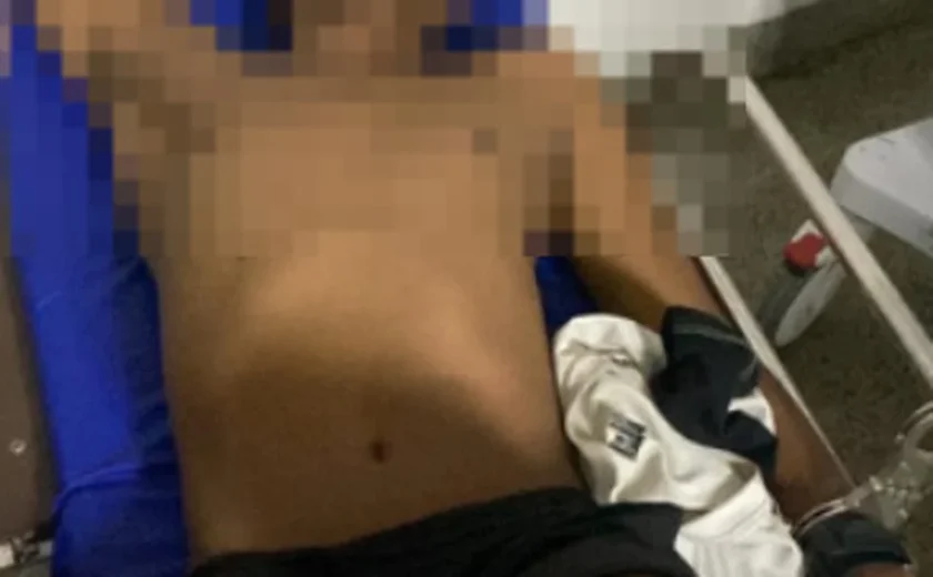 Suposto envolvido na morte de um sargento reformado da PM dá entrada no HGE com tiro na perna