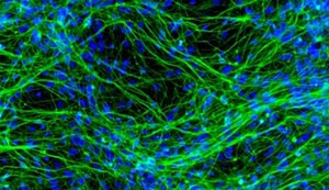 Descoberto o caminho neural causador da ansiedade