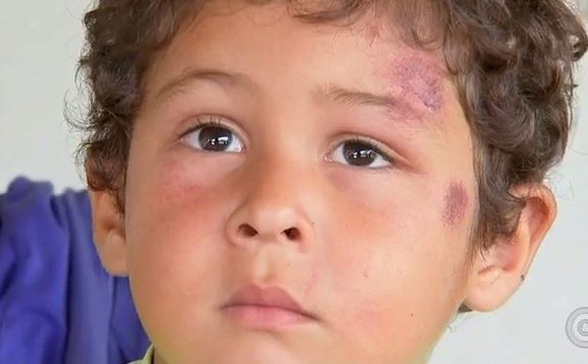 ‘Anjo protegeu meu filho’, diz mãe de menino arremessado de carro em capotamento