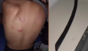 Adolescente é vítima de agressões causadas pela mãe que não aceita sua orientação sexual