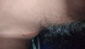 Adolescente de 14 anos é agredida dentro de escola municipal e é levada para o HGE