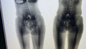 Mulher é flagrada tentando entrar com droga e remédios em presídio