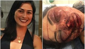 Mulher é agredida e abandonada em estrada pelo companheiro