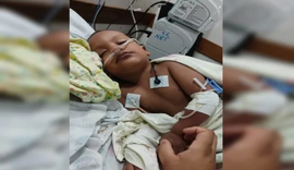 Criança de 2 anos está em estado grave após picada de escorpião
