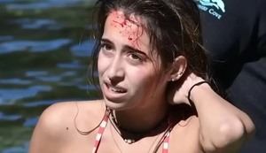 Mulher é mordida na cabeça por crocodilo e sobrevive