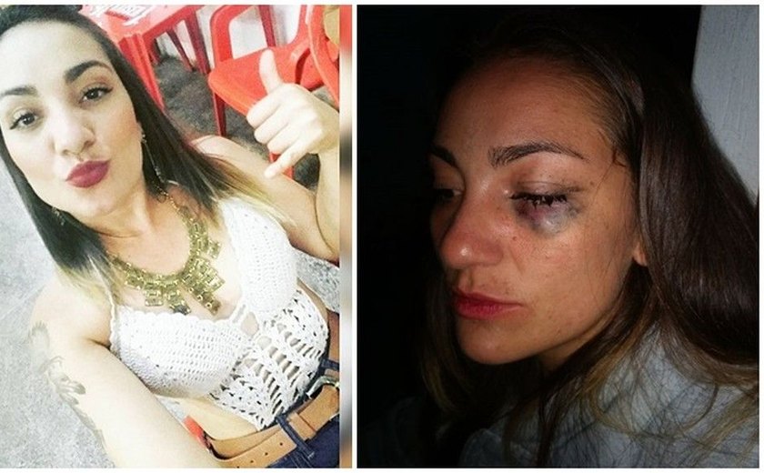 Jovem posta fotos da irmã agredida pelo ex-namorado: 'Não consigo nem olhar para ela'