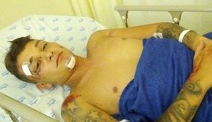 MC Gui sofre acidente de moto no litoral paulista e para no hospital
