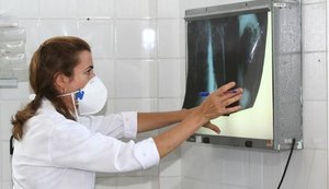 Brasil tem 34% dos casos de coinfecção de tuberculose e HIV do mundo