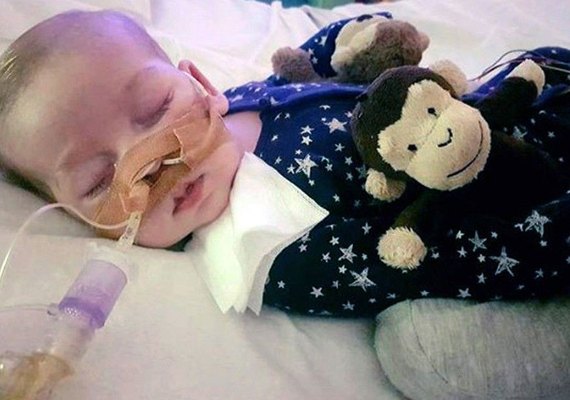 Bebê que sofria de síndrome rara, Charlie Gard morre no Reino Unido
