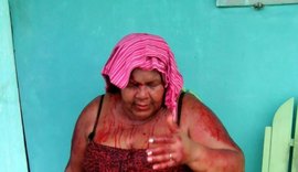 Ex-aluno agride esposa e professora em Campo Grande; docente está em estado grave