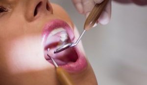Câncer Bucal: dentista alerta sobre os principais sintomas da doença