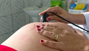Assistência ao parto avança no Brasil, mas pré-natal ainda preocupa