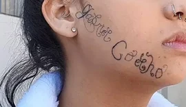 Rapaz que tatuou à força nome no rosto da ex-namorada descumpriu duas medidas protetivas