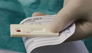Brasil registra 188 mortes por covid-19 nesta quinta