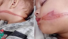 Bebês gêmeos de 1 ano e 6 meses são atingidos por fios soltos em São Paulo