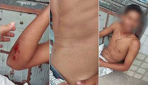 Família de jovem espancado se reúne com superintendente do Ronda no Bairro