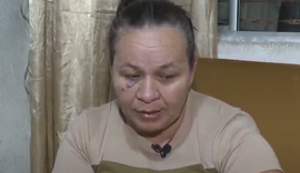 Cozinheira agredida com neto no colo por ex, policial militar, clama por Justiça