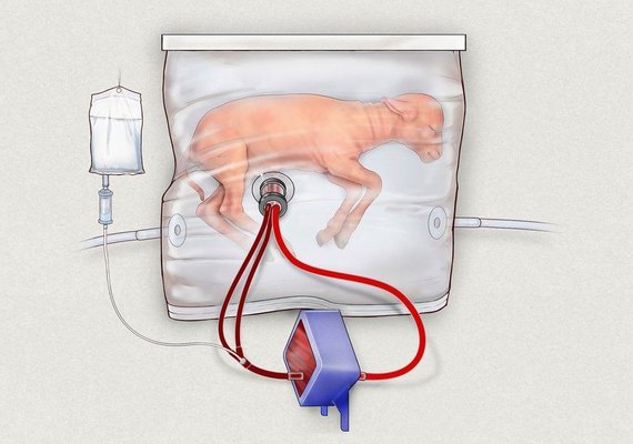 Cientistas desenvolvem útero artificial para ajudar bebês prematuros