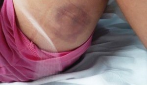'Foi um milagre', diz mãe que viu filha ser baleada após erro de GPS