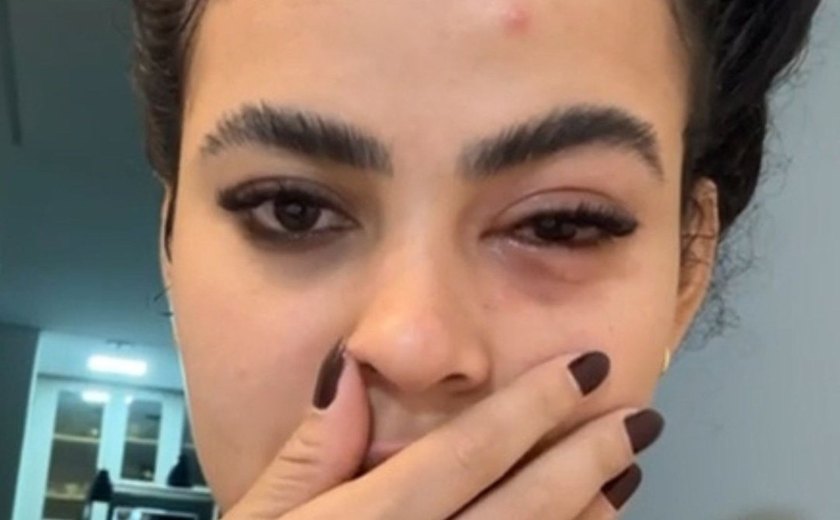 Mulher tem infecção no olho causada por mosca de banheiro