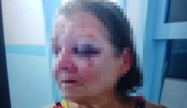 Delegacia de Campo Alegre conclui inquérito de filho que espancou a própria mãe
