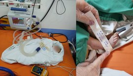 Samu atua em parto pélvico no Benedito Bentes, mas bebê é internado em estado grave