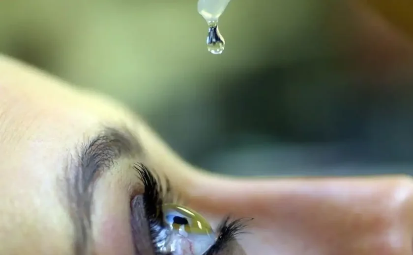 SUS amplia exames para diagnosticar glaucoma, mas acesso desigual preocupa especialista