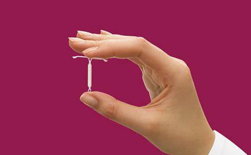 DIU: saiba mais informações sobre o método contraceptivo