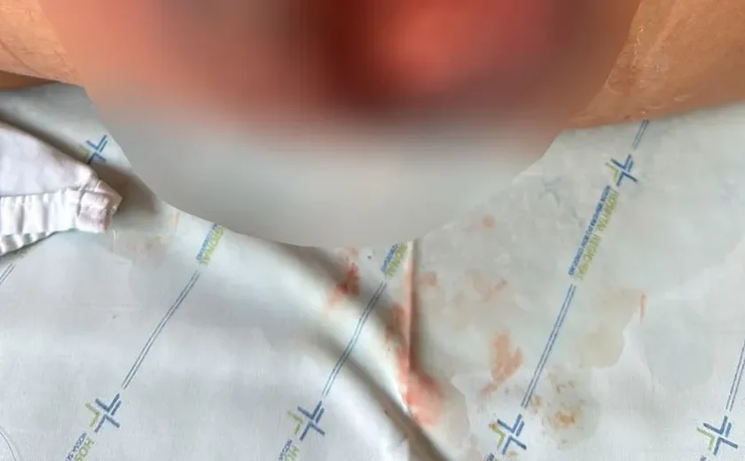 Ambiente insalubre e improvisado: dentista aplicava silicone industrial em casas de pacientes