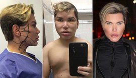 Rodrigo Alves, o Ken Humano, refaz rosto e admite que 'não aceita envelhecer'