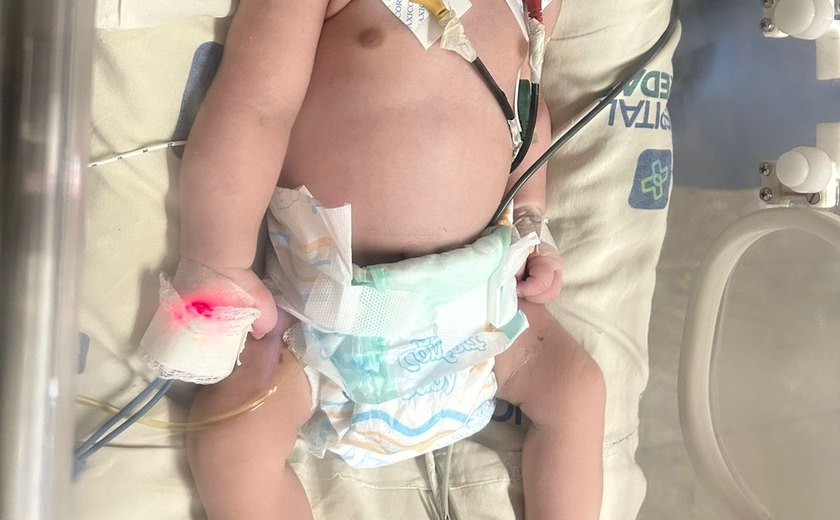 Polícia Civil investiga morte de bebê após parto induzido em hospital particular