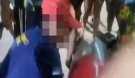 Motociclista fica ferido em colisão com carro de passeio em Japaratinga
