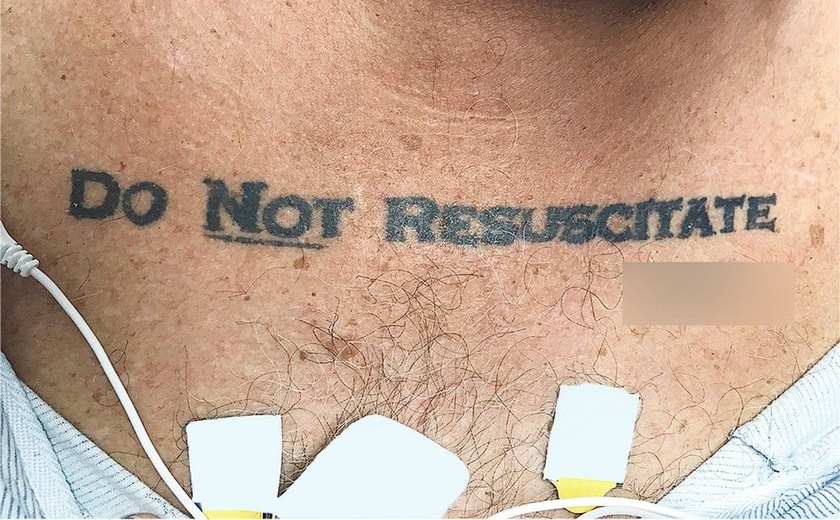 Homem com tatuagem 'não ressuscite' chega inconsciente a hospital e médicos ficam em dúvida