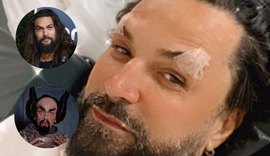 Latino surge irreconhecível após harmonização facial e rende memes: 'Jason Momoa da Shopee'
