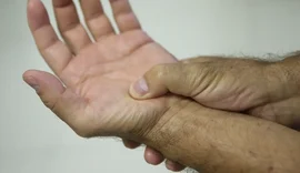 Lei passa a definir fibromialgia como deficiência em todo o país