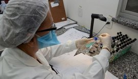 Rede de Teste Rápido Molecular para Tuberculose é ampliada em Alagoas