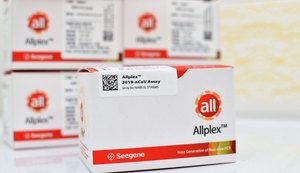 Lacen/AL aumenta estoque de kits RT-PCR para ampliar diagnósticos
