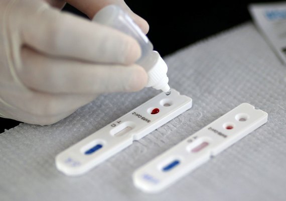 Começa testagem de Covid-19 em farmácias de Maceió